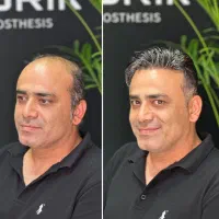 کلینیک تخصصی پروتزمو سبزوار