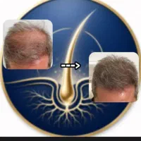 تونیک دوقلو اگسونیک رویش مجدد ضد ریزش