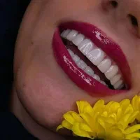 جشنواره کامپوزیت دندان/عصب کشی/ اقساطی ویژه