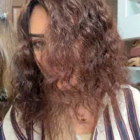 پروتز مو