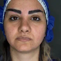 جشنواره کاشت ابرو با تراکم بالا فقط 10تومن
