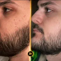 برای ریش کم پشت یه راه متفاوت هست