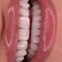 دندانپزشکی