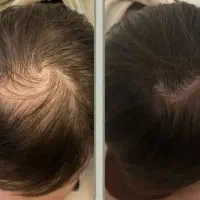 اون قسمت موهات هنوز خالیه