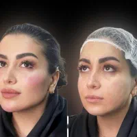 ارائه خدمات زیبایی و لیزر