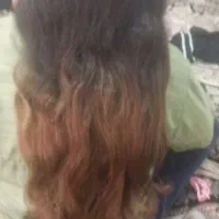فروش مو