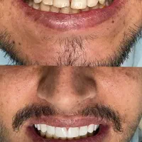جشنواره دندانپزشکی در کرمانشاه