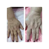 پاکسازی وفشیال تخصصی(باتخفیف ویژه )وبهترین برند