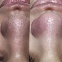 فشیال و پاکسازی۲۰۰ فردیس
