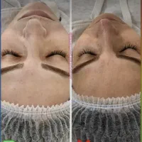 فرصت محدود ۵۰٪ تخفیف ویژه برای فیشیال تخصصی