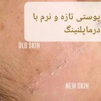 انجام خدمات پاکسازی پوست بانوان