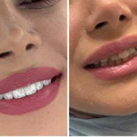 مرکز تخصصی ایمپلنت