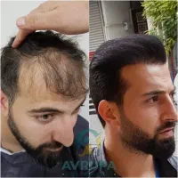 بازگشت تراکم