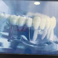 دستیار دندانپزشک
