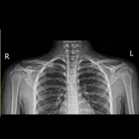 رفع اشکال و آموزش شیمی غیرحضوری  پایه دوره دوم