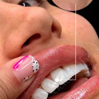 لبخندی زیبا با بیمه طلایی شو50٪