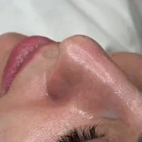 اموزش پاکسازی پوست