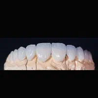 دندانپزشکی  و لمینت تعرفه دولتی