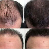 اکسیر جوانی