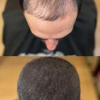 موهاتو نجات بده