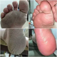 پدیکور تخصصی(VIP)هدیه ویژه/خدمات ناخن/فیشال دست