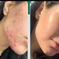بهترین خدمات فیشال تخصصی در یزد