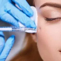 مدل خانم برای تزریق ژل لب و صورت کاملا رایگان