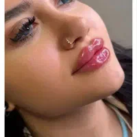 ژل و بوتاکس فقط هر سی سی ۱۴۰۰