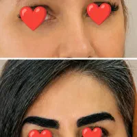 کاشت ابرو تضمینی