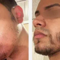 مو و ریش در ۲۵ روز عدد 4 پیامک کن