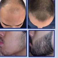 ریشتو پنهون نکن