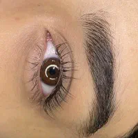 کاشت مژه