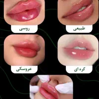 تخفیفات محرم ژل وبوتاکس