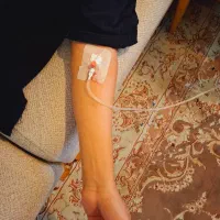 تزریقات و سرم تراپی در منزل توسط پرستار خانم و آقا