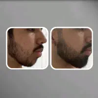 مردشو|آرایشی، بهداشتی، درمانی|عسلویه, |دیوار