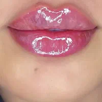 ژل و بوتاکس لیزرموهای زائدپاک کردن تتو،دستگاهلاغری