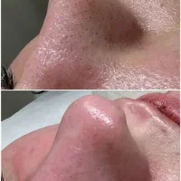 آی پارا