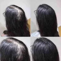 قطش کن