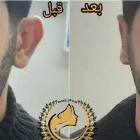لب گونه