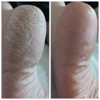کفسابی بانوان ارزانتر ازپارسال