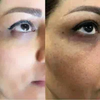 کرم معجزه چهل گیاه اصل