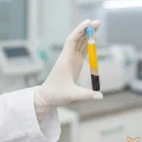 انجام PRP تخصصی در کلینیک دکتر احیاکننده