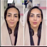 کلینیک تخصصی فرسیما/بوتاکس/فیلر/نخ لیفت