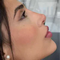 نیازمند مدل چهره برای کلینیک زیبایی