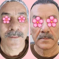 هایفو دابلو گلد