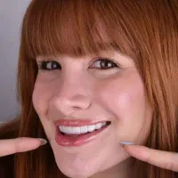 کامپوزیت روکش سرامیکی لمینت عصبکشی دندانپزشکی