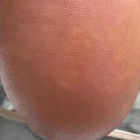 پدیکور|خدمات زیبایی و سلامت|مهاباد (آذربایجان غربی), |دیوار