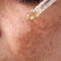 حل مشکلات پوستی