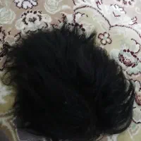 پروتز مو