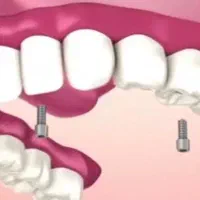 دستیار دندانپزشکی